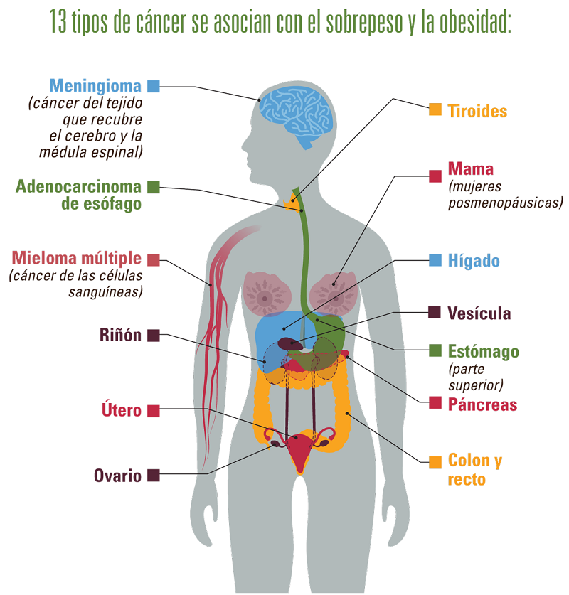 Obesidad, cáncer y horario de ejercicios para pérdida de peso efectiva