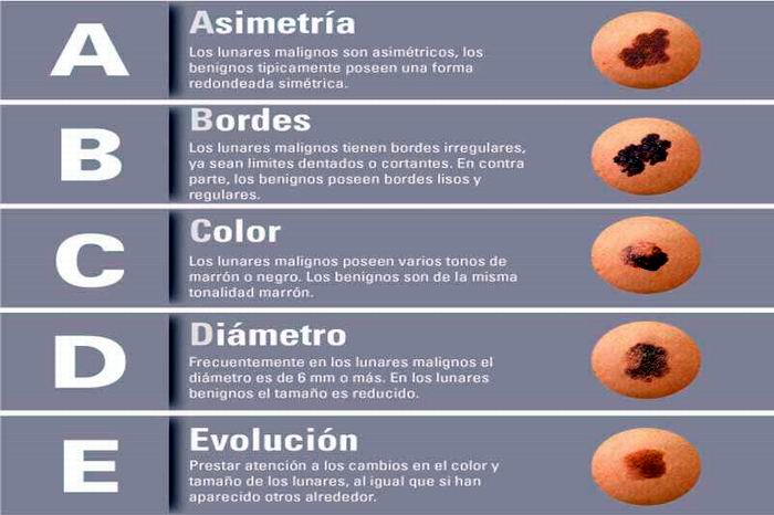 El cáncer de piel se cura El cáncer de piel se cura