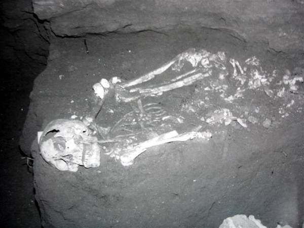 Paleopatología aborigen.