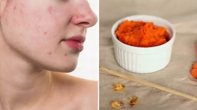 Zanahoria contra el acn� y las estr�as 