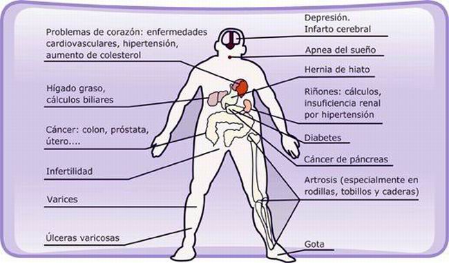 Riesgos de la obesidad
