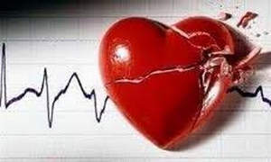 Infarto cardíaco Infarto cardíaco