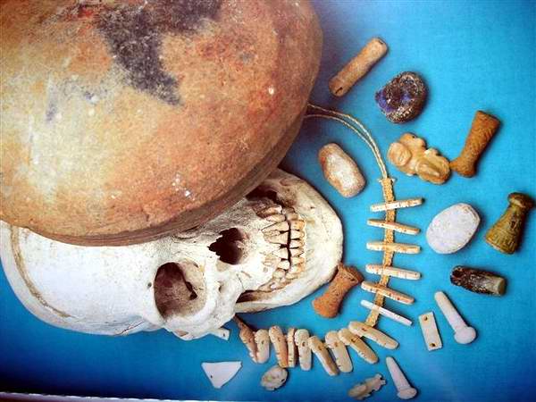 Paleopatología aborigen.