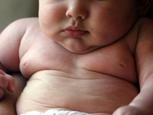 Obesidad infantil