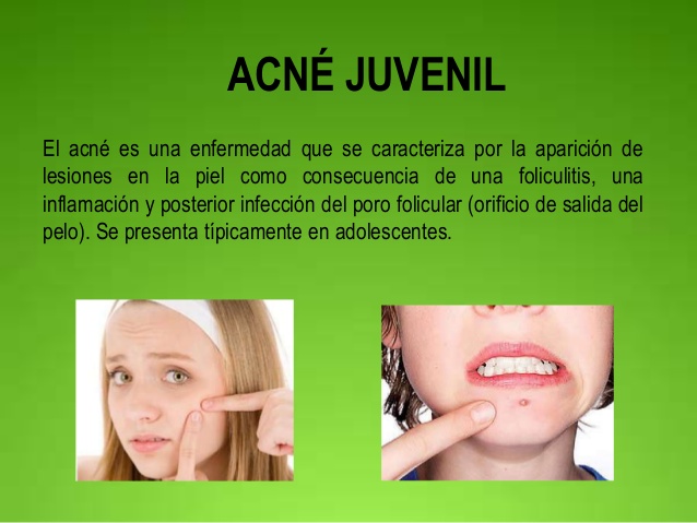 Para el acné juvenil 