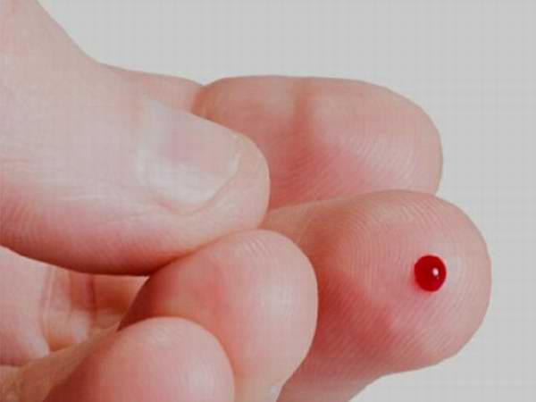 Análisis de sangre. Análisis de sangre.
