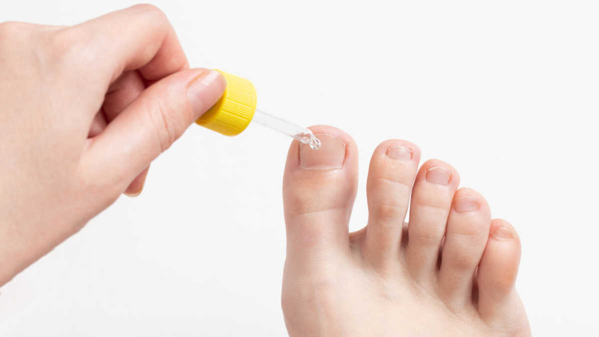 La mejor cura para los hongos de las uñas de los pies