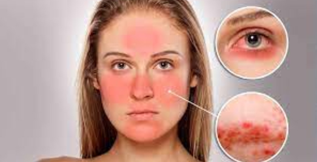 Elimina las bacterias de tu rostro