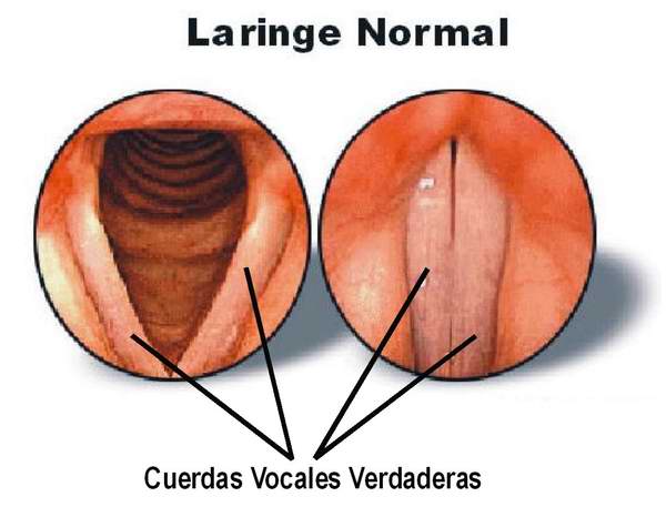 Cuerdas vocales.