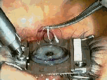 Atención oftalmológica