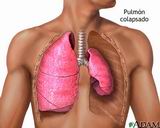 Pulmones