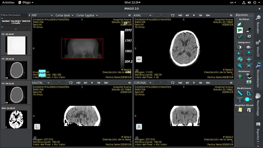 Imagis, un software al servicio de la salud pública