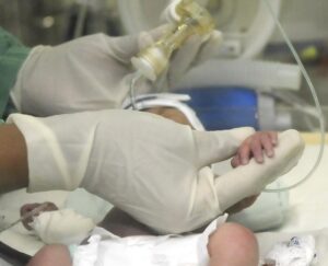 SUMA servicio neonatal Cuba