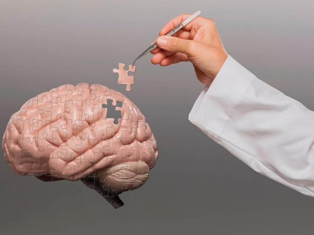 Enfermedad de Alzheimer